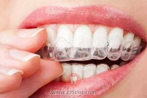 口腔正畸是什么意思