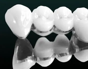 杭州钛合金烤瓷牙价格