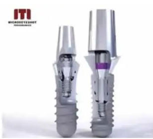 杭州瑞士种植体iti的价格区间