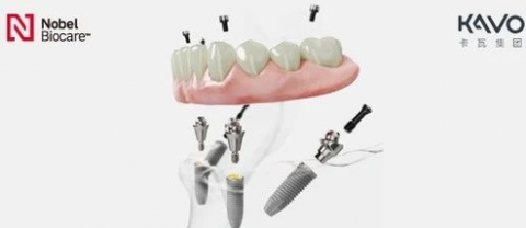 种植牙是怎么种到嘴巴里的？