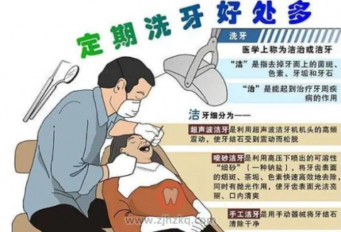 洗牙真的会伤牙