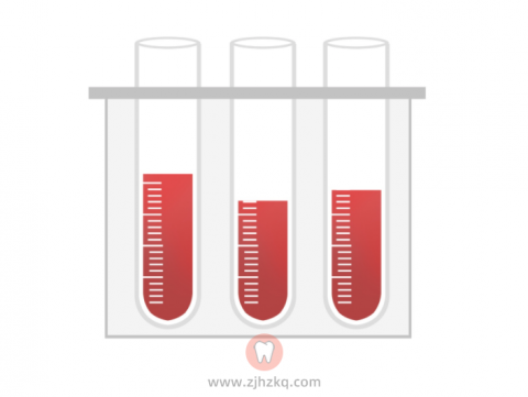 杭州看牙是否要抽血验血报告