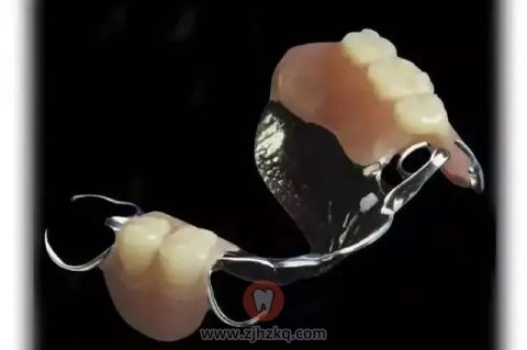 杭州活动假牙选哪种材料好