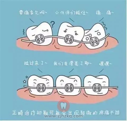 杭州牙齿矫正全流程完整版