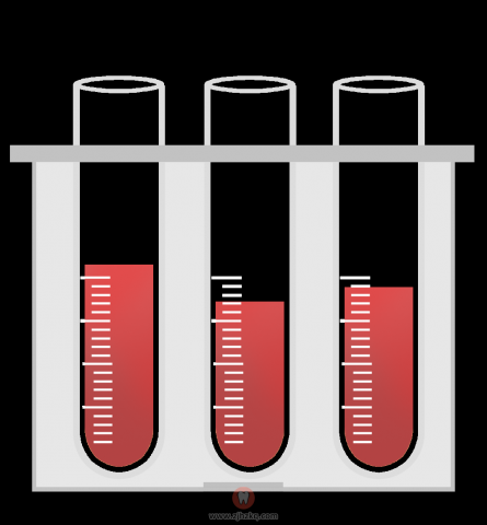 杭州看牙是否要抽血验血报告