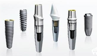 如何选择适合的种植体