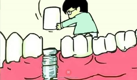 种植牙手术好痛好可怕