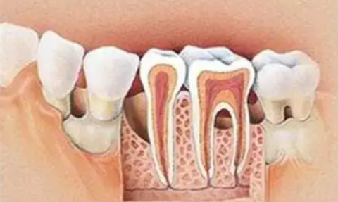 牙齿松动到底是什么原因导致的