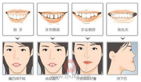 我在杭州32岁了还能整牙吗