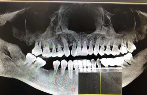 杭州牙医徐锦文的门诊看牙故事