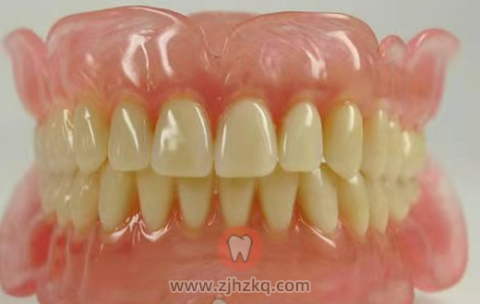 杭州瑞创口腔连锁缺失牙种植牙科普