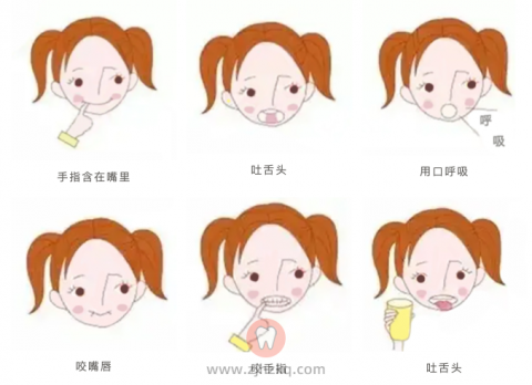 杭州口腔医院和睦院区早期矫正科普