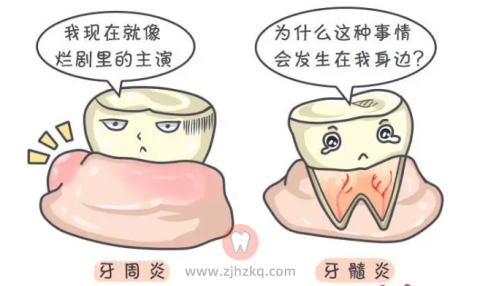 杭州口腔牙周炎牙髓炎科普