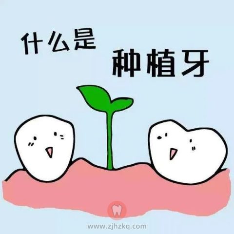 杭州想要做种植牙的这些疑问90%的人都没搞清楚