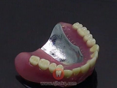 杭州口腔宣教专栏口腔修复都有哪些