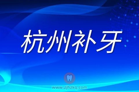 杭州补牙一般多少钱一颗实际价格以就医为准