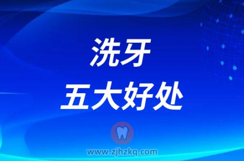 洗牙的五大好处