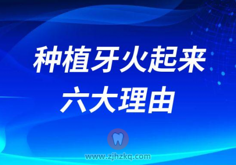 种植牙火起来的六大理由