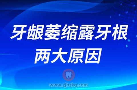 牙龈萎缩露牙根两大原因