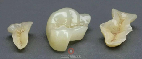 牙齿缺损三大修复方式