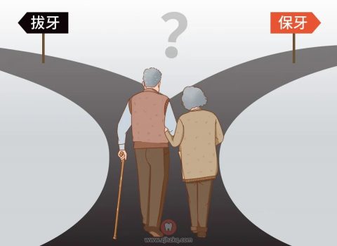 老年人牙齿松动要不要拔牙