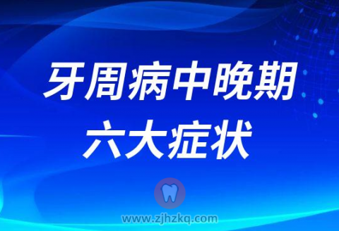 牙周病中晚期六大症状