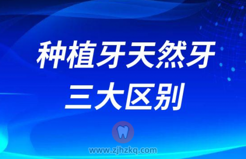 种植牙天然牙三大区别