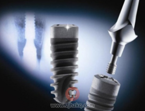 德国Ankylos费亚丹种植牙介绍