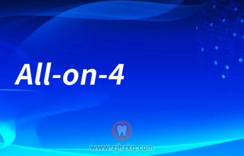 All-on-4种植牙四大特点