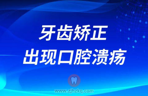牙齿矫正出现口腔溃疡有没有危害风险