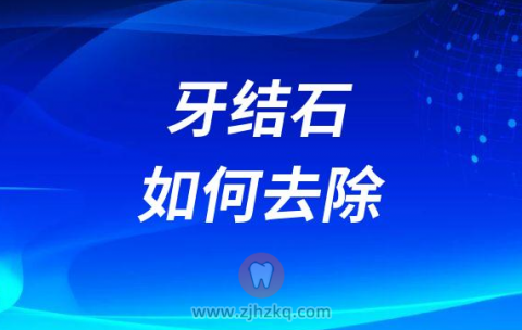 牙结石自己抠会不会损伤牙齿如何快速除去