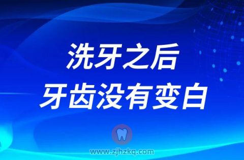 洗牙之后牙齿没有变白是不是被骗了