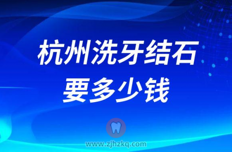 杭州洗牙结石要多少钱
