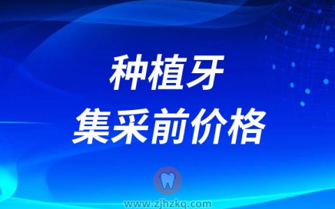 2023年杭州种植牙集采前价格曝光