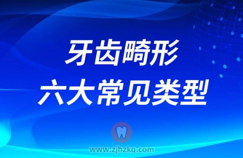 牙齿畸形六大最常见的类型
