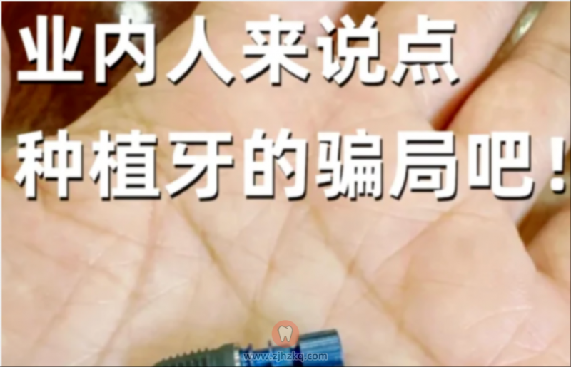 种牙血泪史！种牙时千万别被牙医忽悠了，这5类人根本不适合做种植牙。做了种植牙后，我后悔了..没人说的种植牙致命缺点，附种植牙最新价格表